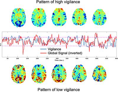 Vigilance Effects in Resting-State fMRI